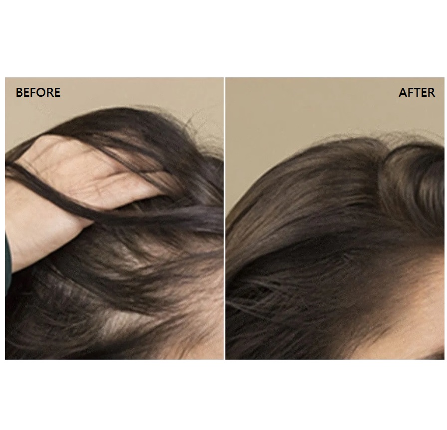 Rene Furterer Triphasic Reactional Serum 12 x 5ml 突發性脫髮精華素
